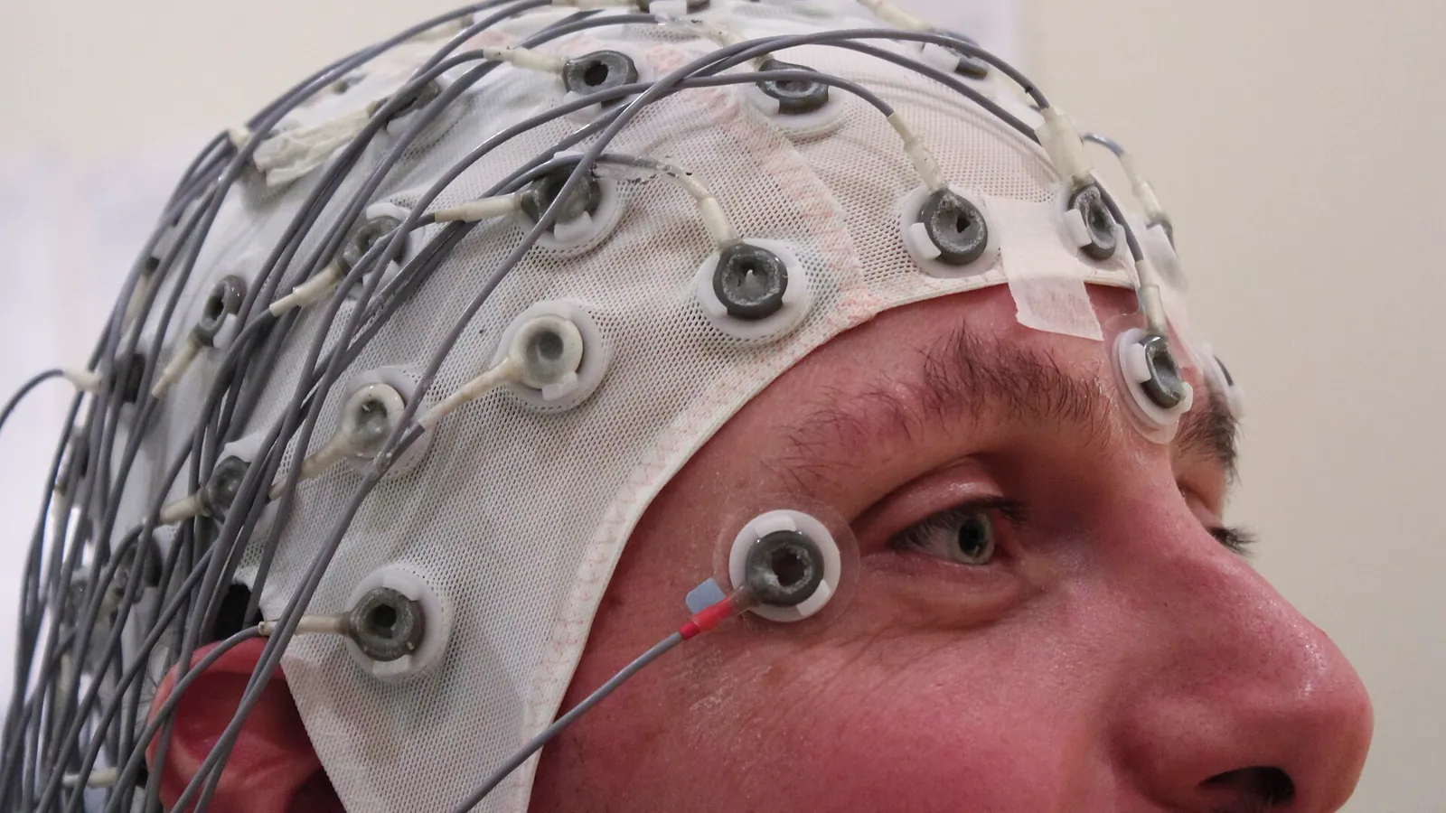 คนสวมหมวก EEG ที่มีขั้วอิเล็กโทรดและสายไฟจำนวนมากบนศีรษะ